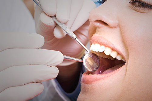 Start Fresh This Year With a January Dental Reset